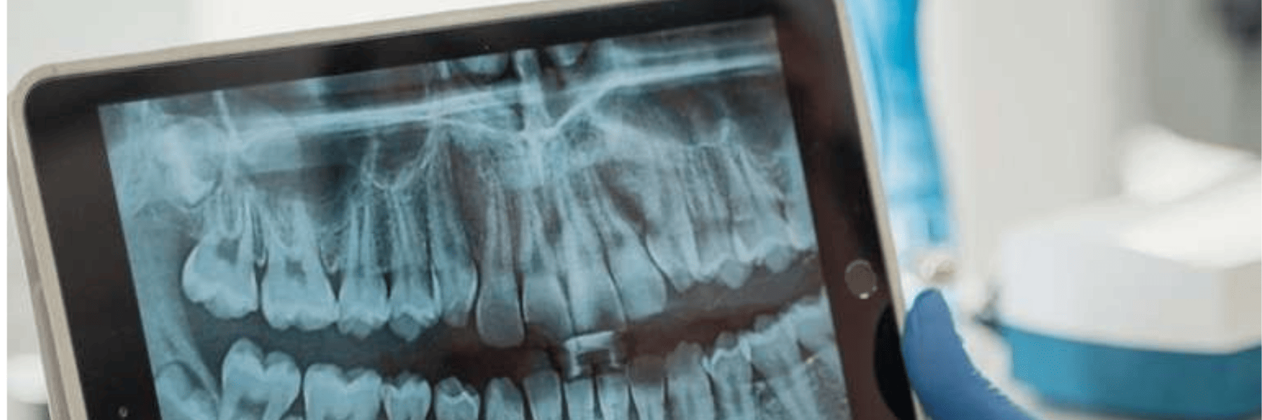 Ipad with dental xrays, indianapolis indiana